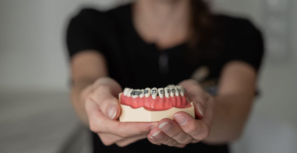 Aparat ortodontyczny