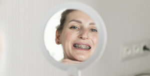 Aparat ortodontyczny – wszystko, co powinieneś wiedzieć