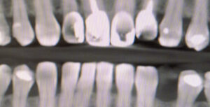 diagnostyka RTG chorzów