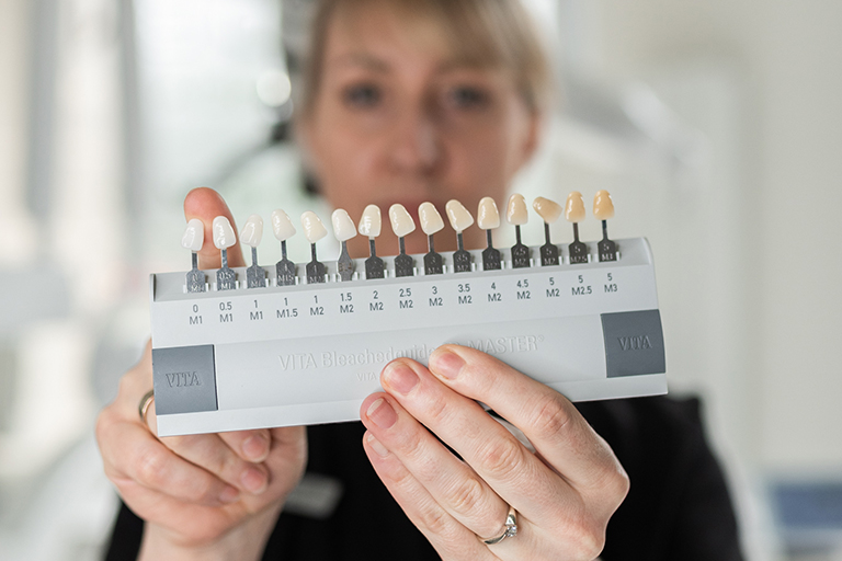 licówki - tendent chorzów