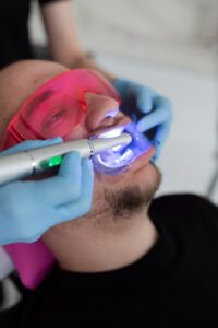 Wybielanie zębów Chorzów