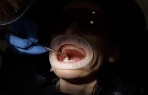 Zęby mądrości a stan zapalny