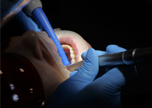 Zakażenie i ból po wyrwaniu zęba