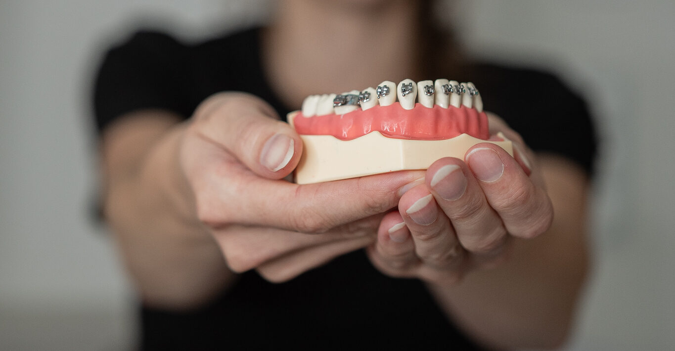 ortodoncja dorosłych