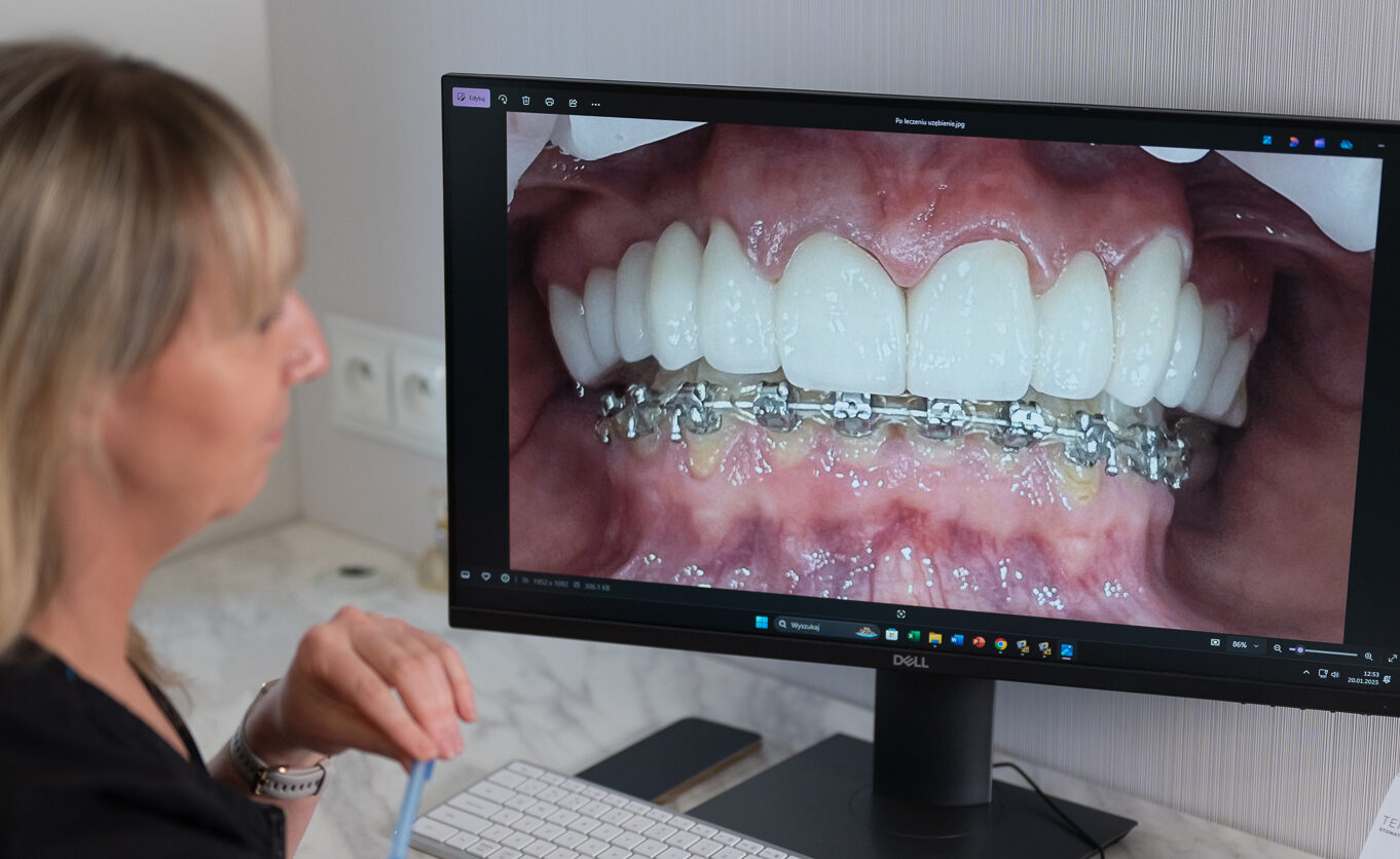 Aparat ortodontyczny a wakacyjne przekąski